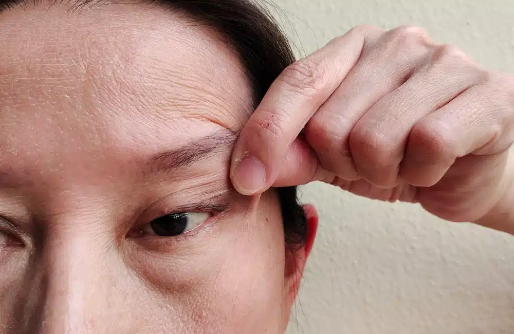 สาเหตุของกล้ามเนื้อตาอ่อนแรง